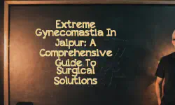 Featured image of post Extreme Gynecomastia in Jaipur: A Comprehensive Guide to Surgical Solutions